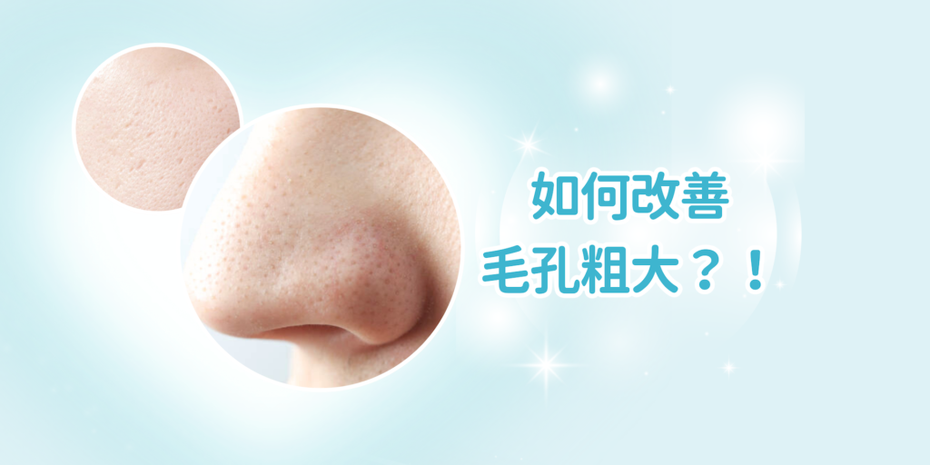 【毛孔粗大】毛孔粗大怎麼辦？即睇3種有效改善方法